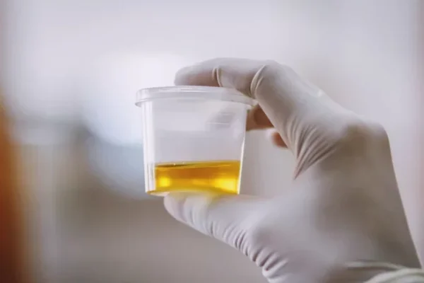 How to observe "urine" dangerous signs "kidney disease"